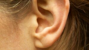 Could a Simple Earlobe Crease Be a Hidden Warning Sign for Life-Threatening Heart Disease?