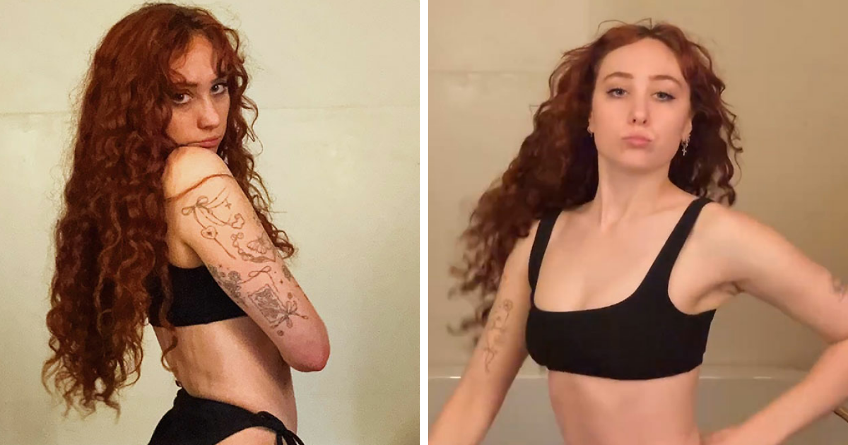 Chappell Roan Stuns Fans with Jaw-Dropping Transformation—What She Revealed Next Will Surprise You