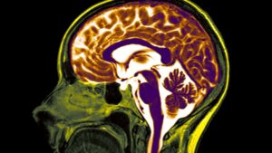 Harvard Scientists Unveil ‘Brain Scorecard’ That Predicts Your Hidden Risk for Cancer, Dementia, and Depression—Are You at Danger?