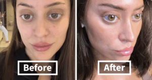This 28-Year-Old’s Facelift Is So Shocking, It’s Leaving Everyone Questioning What’s Real.