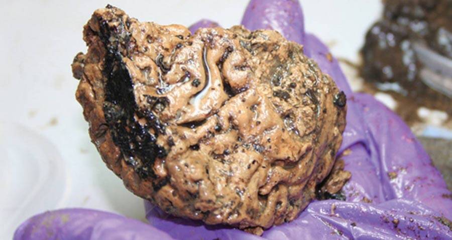 Unlocking the Secrets of Time: How an Intact 2,600-Year-Old Brain Might Rewrite Human History!