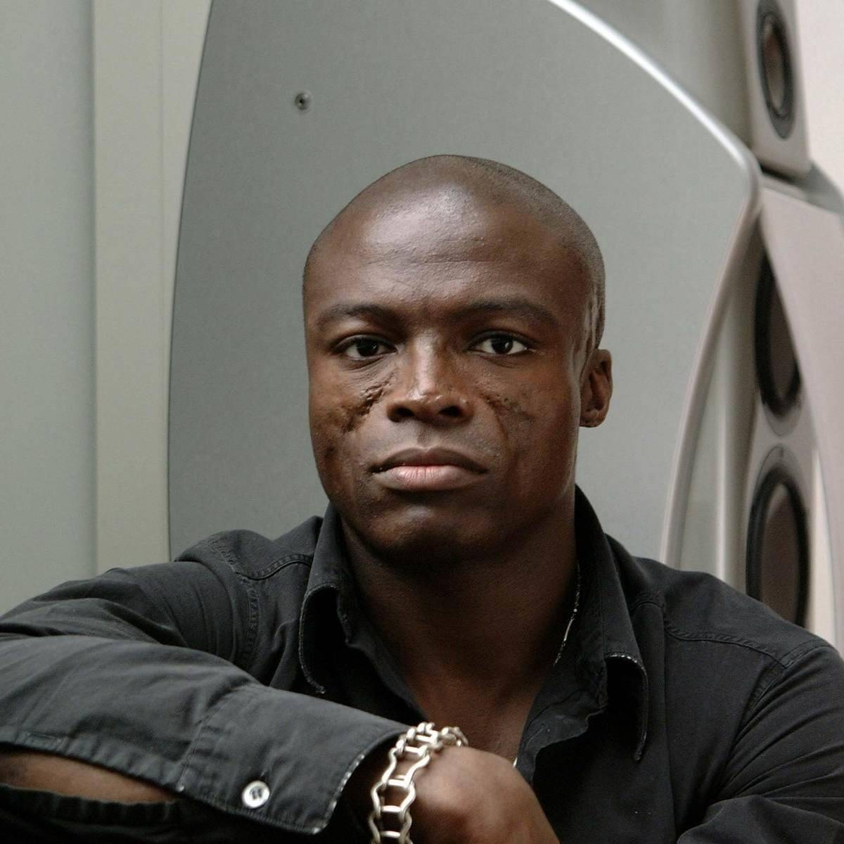 "Unveiling the Truth: Seal Reveals the Harrowing Story Behind His Iconic Facial Scars"