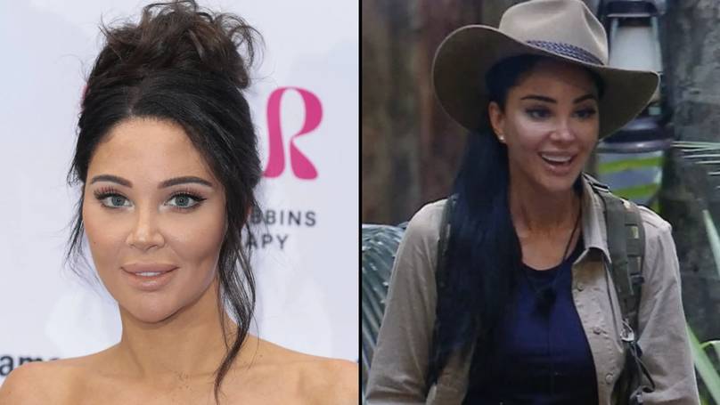 "Unlocking the Mystery: Tulisa's Emotional Journey Behind Her Cosmetic Transformation Will Leave You Speechless!"