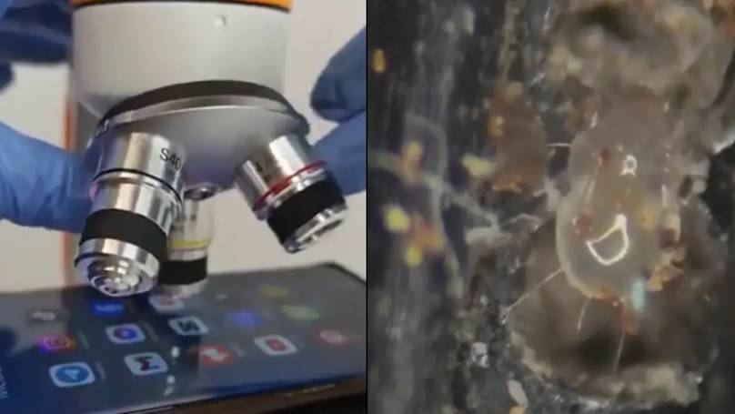 "Unmasking the Microbial Horror: What Your Phone Really Harbors Revealed Under a Microscope!"