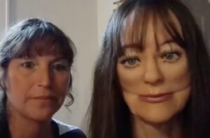 "Survivor's Remarkable Transformation: How a Woman's Battle for Identity Begins with a Shockingly Realistic Prosthetic Face After a Tragic Accident"