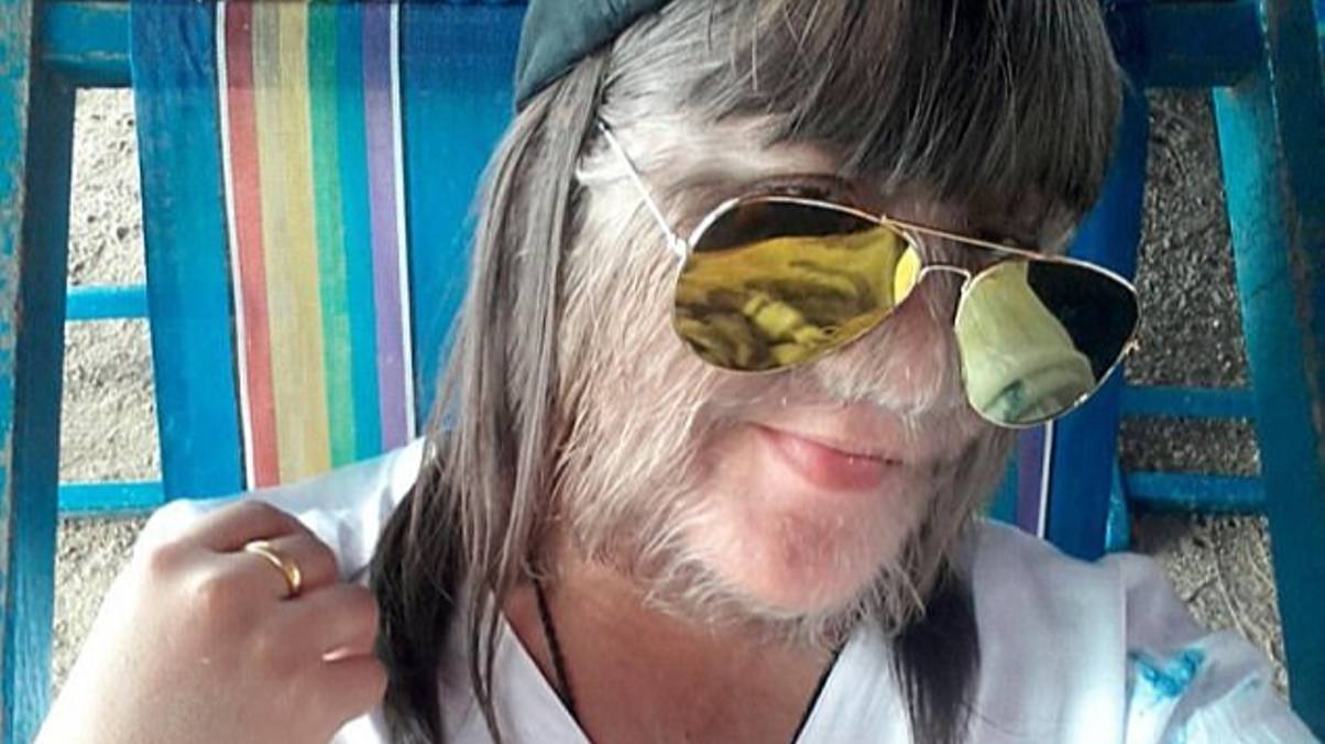 From Record-Breaking Hair to a Surprising Transformation: What Made the World’s Hairiest Teenager Shave Her Face?