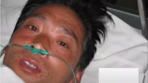 Man Endures Unimaginable Ordeal: 83 Days of Agony and Crying Blood Before Fate Unfolds
