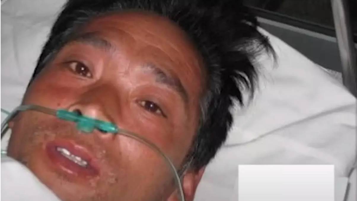 Man Endures Unimaginable Ordeal: 83 Days of Agony and Crying Blood Before Fate Unfolds