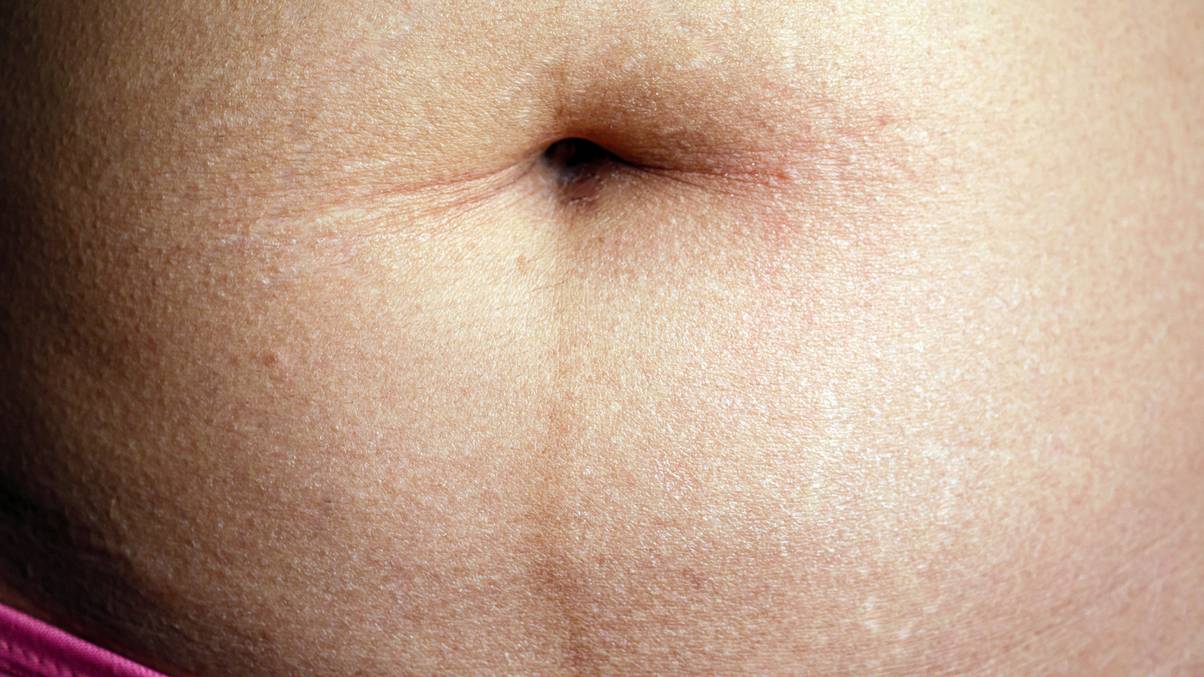 The Mysterious Dark Line on Your Belly Revealed—What It Means Will Surprise You
