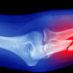 What Your Unbroken Bones Might Secretly Reveal – Doctor Breaks Silence on Strange Theory