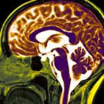 Harvard Scientists Unveil ‘Brain Scorecard’ That Predicts Your Hidden Risk for Cancer, Dementia, and Depression—Are You at Danger?