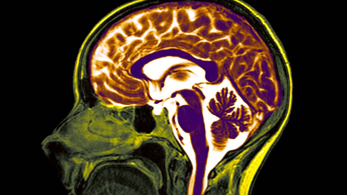 Harvard Scientists Unveil ‘Brain Scorecard’ That Predicts Your Hidden Risk for Cancer, Dementia, and Depression—Are You at Danger?
