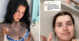 Kylie Jenner Spills Shocking Secrets Behind Her Breast Augmentation—Fans Won’t Believe What She Revealed!