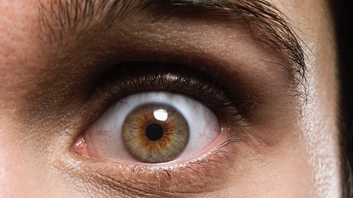 The Shocking Vision Truth Affecting 300 Million – Why Men Are Most at Risk