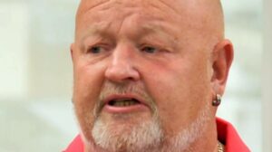 30-Year-Old Mystery Lump on Man’s Head Reveals Shocking Secret from Cricket Game Incident