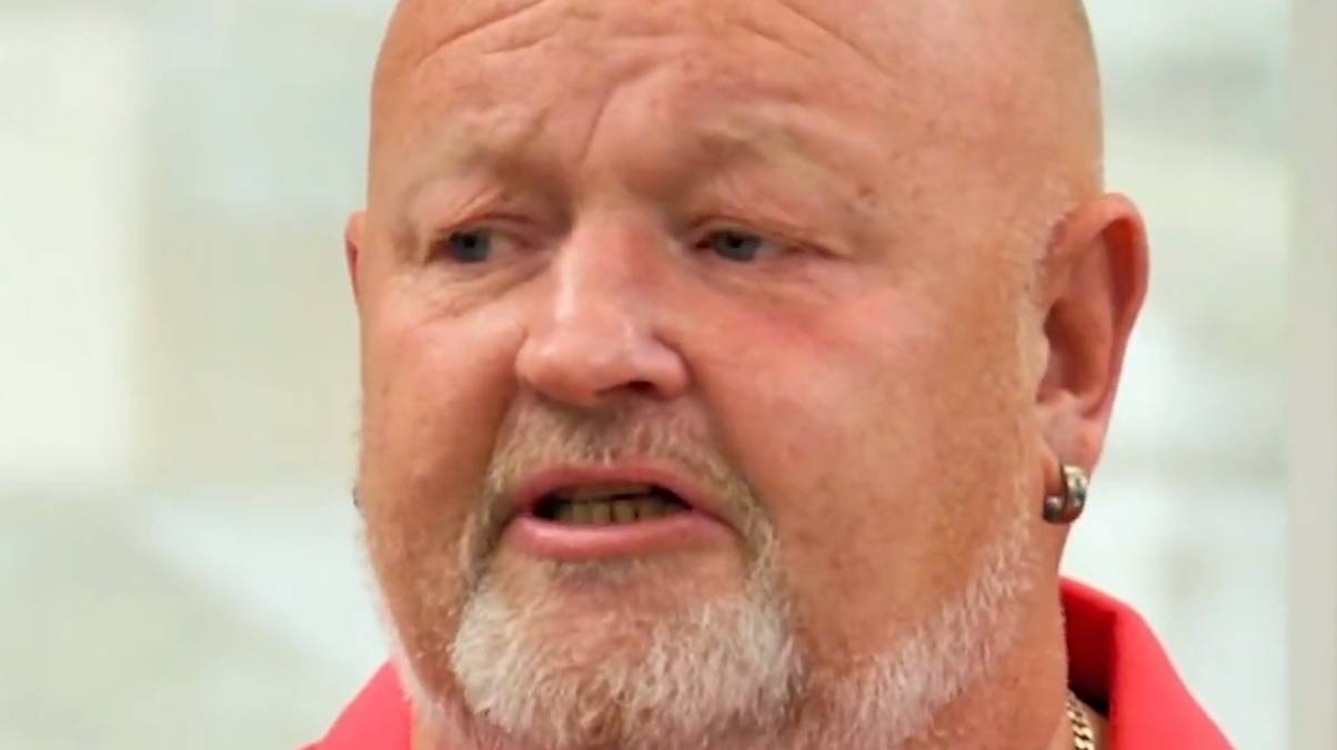 30-Year-Old Mystery Lump on Man’s Head Reveals Shocking Secret from Cricket Game Incident