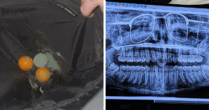 62 Hilarious Moments When Forgetfulness Led to Unbelievable Blunders You Won’t Believe!