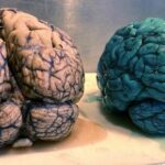 Mystery Pill Turns Patient’s Brain Blue: Doctor Uncovers Shocking TikTok Trend Consequence