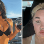Amanda Bynes Stuns Fans with Unbelievable Transformation Following Secret Kylie Jenner-Inspired Procedure