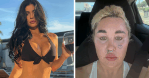 Amanda Bynes Stuns Fans with Unbelievable Transformation Following Secret Kylie Jenner-Inspired Procedure