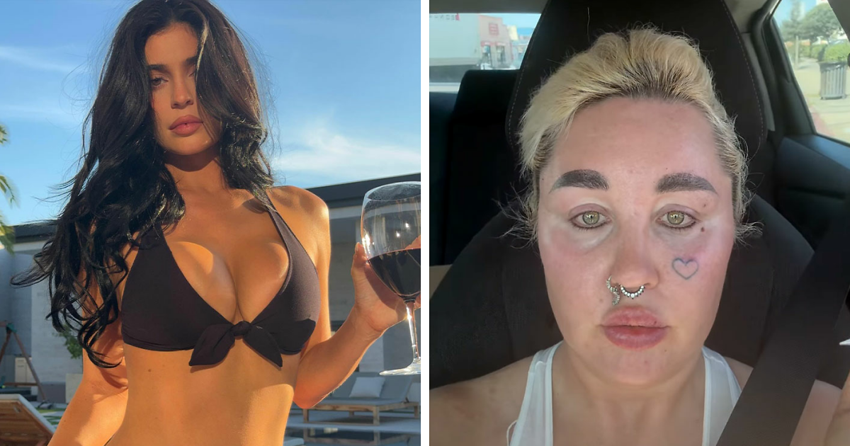 Amanda Bynes Stuns Fans with Unbelievable Transformation Following Secret Kylie Jenner-Inspired Procedure