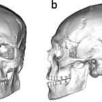 Ancient Mystery Unearthed: 12,500-Year-Old Skull Reveals Europe's Earliest Cranial Modification—What Secrets Does It Hold?