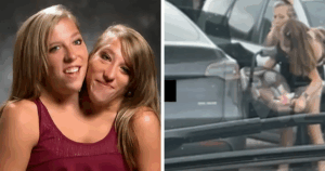 Conjoined Twins Abby and Brittany Hensel Turn Heads with Unexpected Newborn Moment—What Happened Next Will Surprise You!