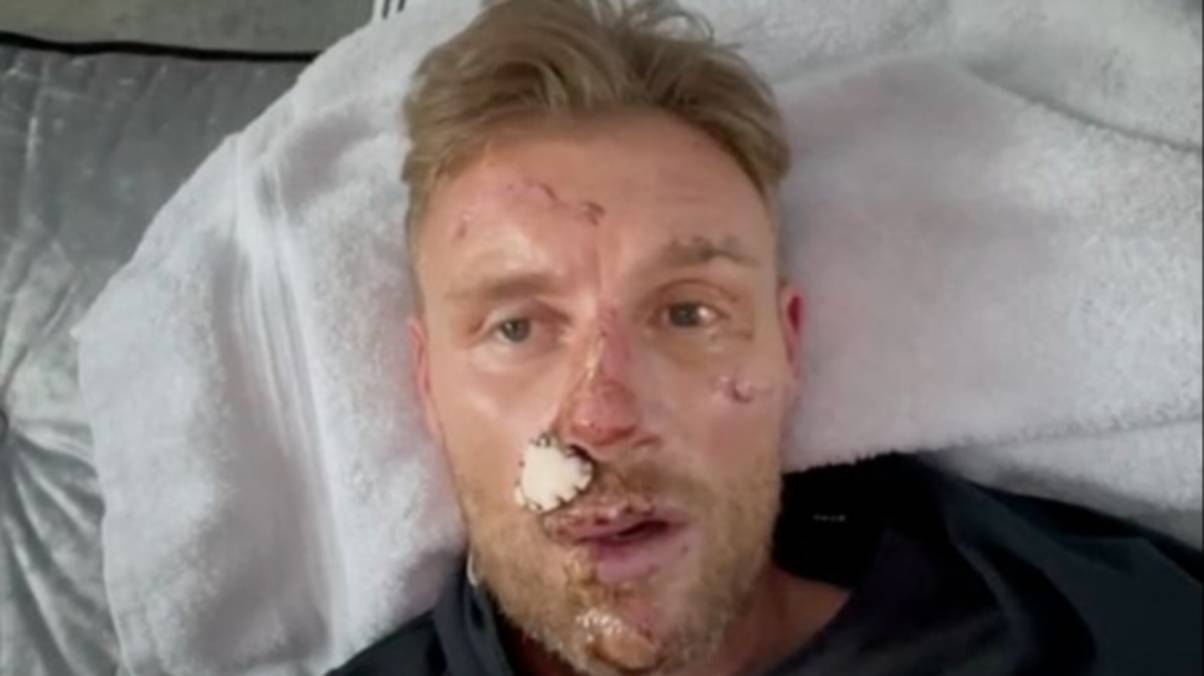 Freddie Flintoff Reveals Shocking Truth Behind Top Gear Crash That Nearly Claimed His Life