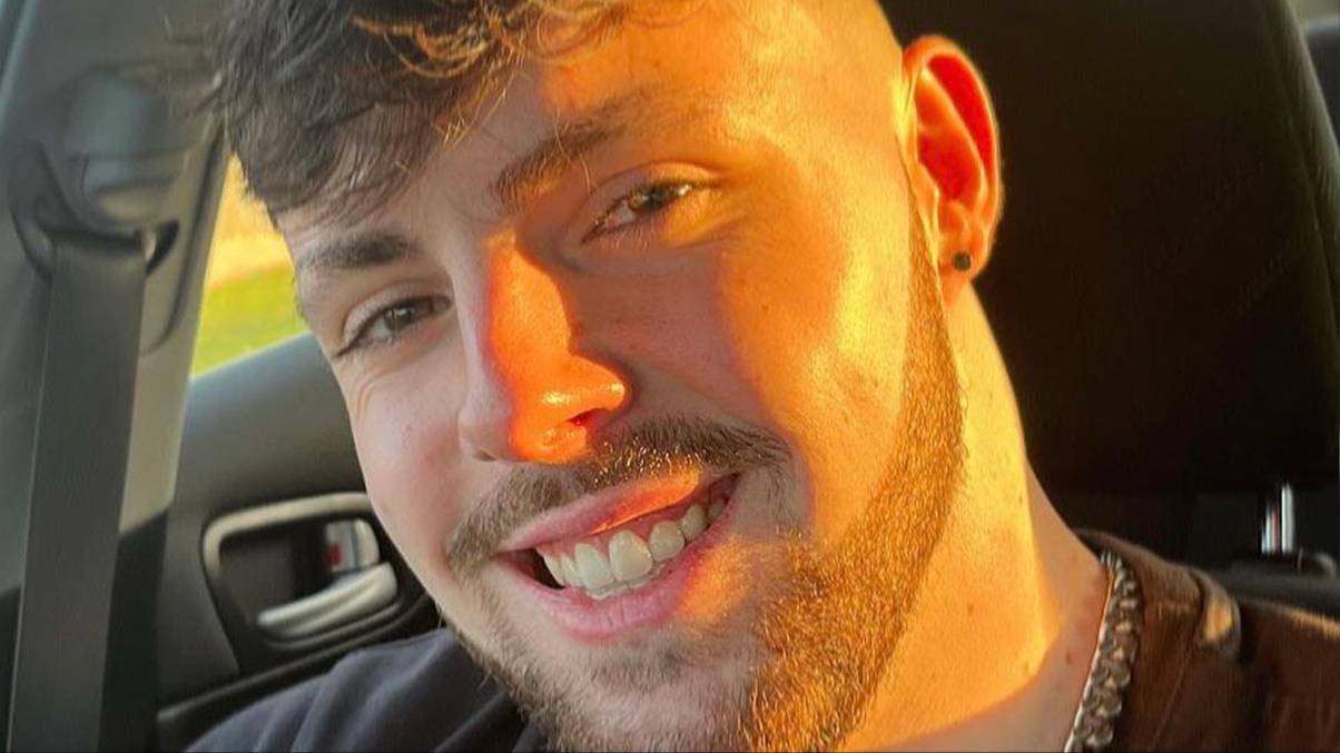 The Shocking Consequences of Ignoring the 'No Sex' Rule After Hair Transplant Surgery Revealed