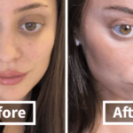This 28-Year-Old’s Facelift Is So Shocking, It’s Leaving Everyone Questioning What’s Real.