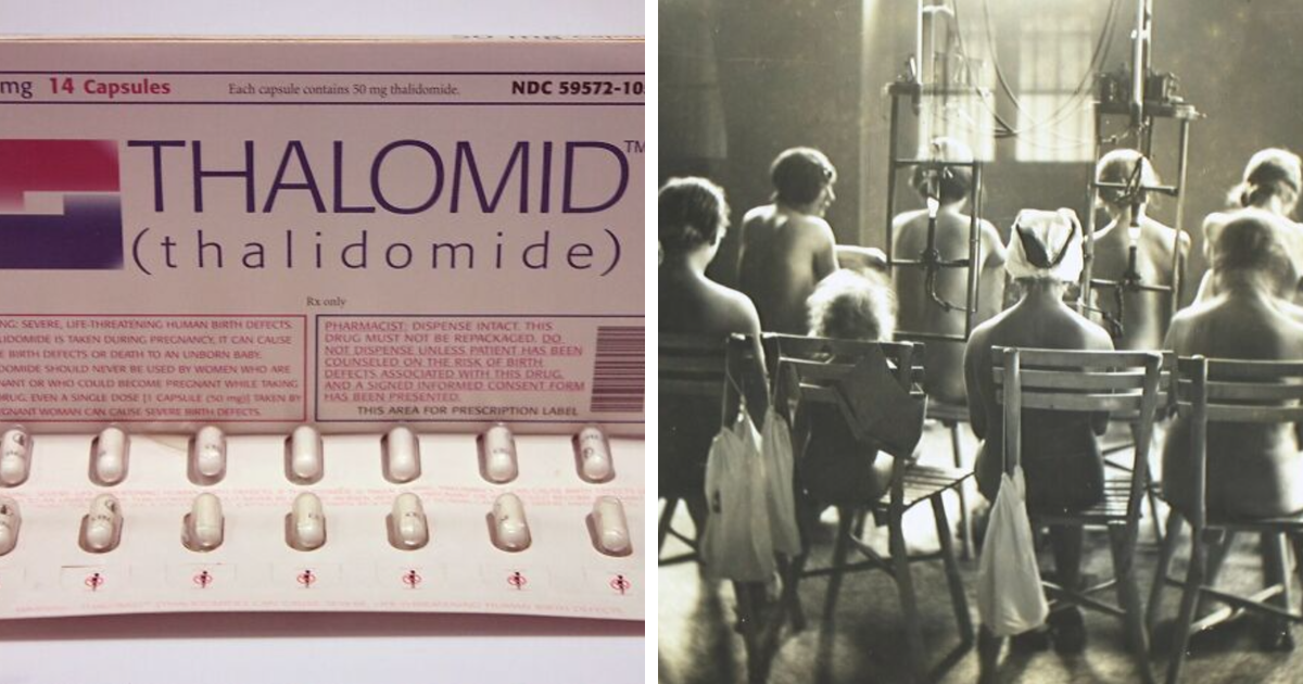 Unbelievable Vintage Medical Photos That Will Haunt Even the Bravest Med Students