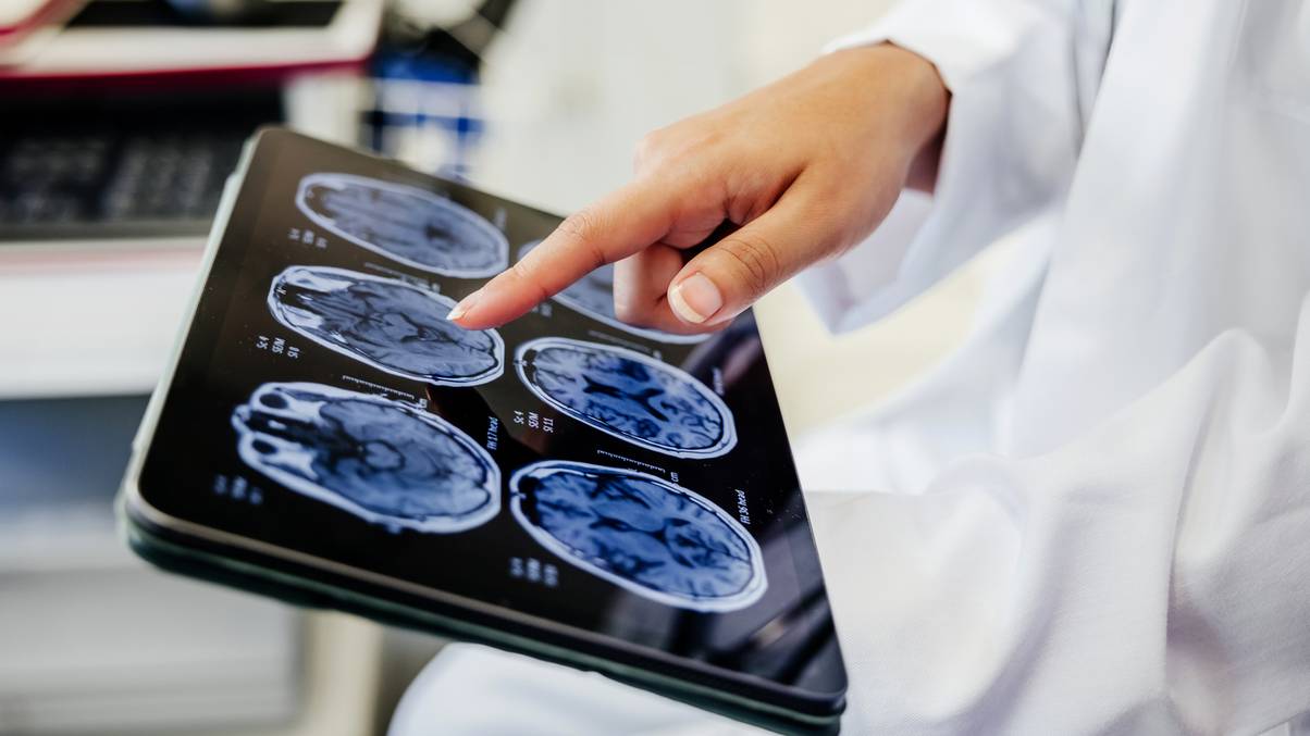 Unlocking Eternity: The Mysterious Protein That Might Turn Back Time in the Brain