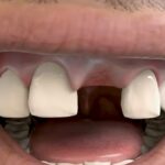 YouTube Simulation Unlocks Shocking Truth Behind Your Most Terrifying Nightmare