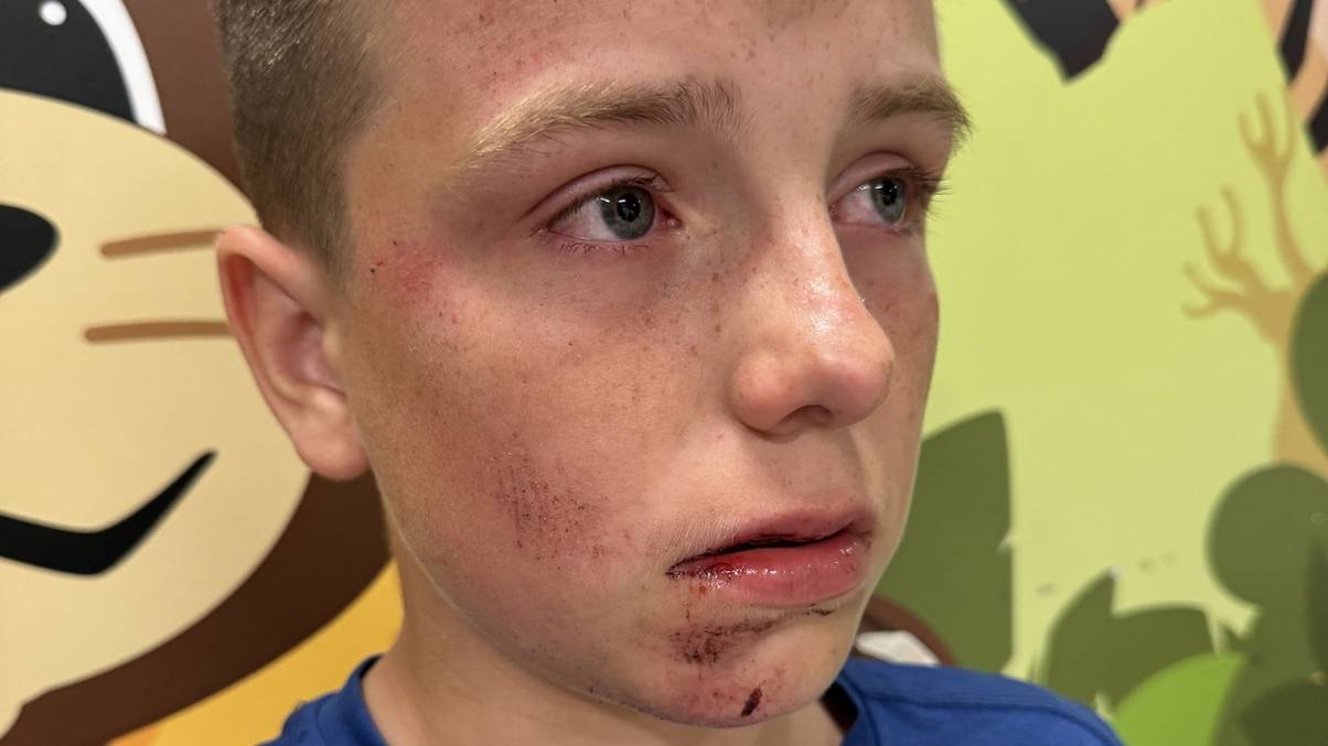 Teen's Viral Playground Dare Turns Horrific: Shocking Injury Leaves Experts Stunned