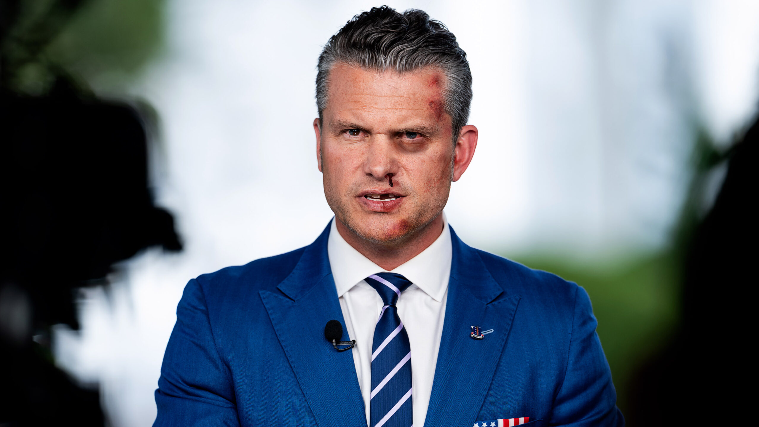 Fox Host’s Mysterious Bruises Spark Wild Claims About a Sinister Barstool Plot