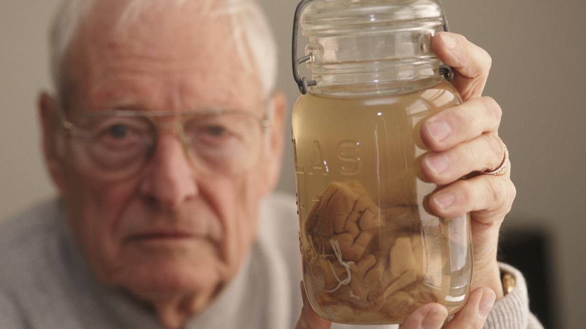 Inside the Dark Secret: How a Doctor Hid Einstein’s Brain for Half a Century in Plain Sight