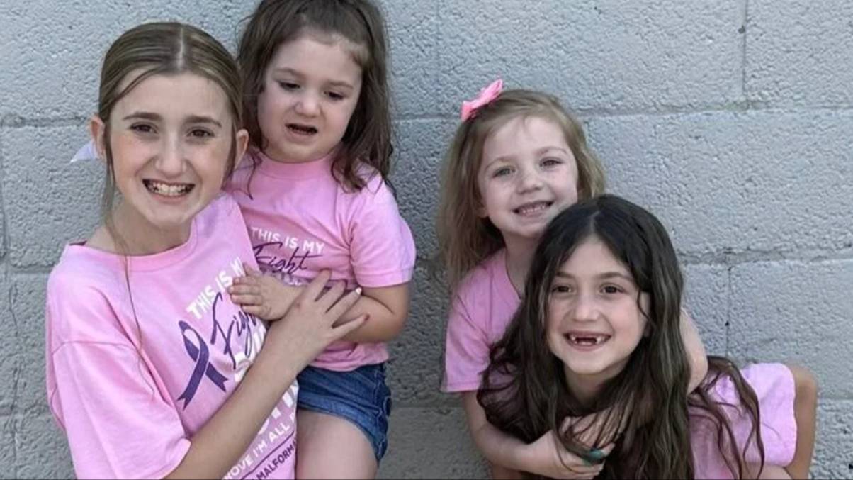 Unbelievable Medical Mystery: Four Sisters Stricken by a Rare Brain Condition Threatening Paralysis