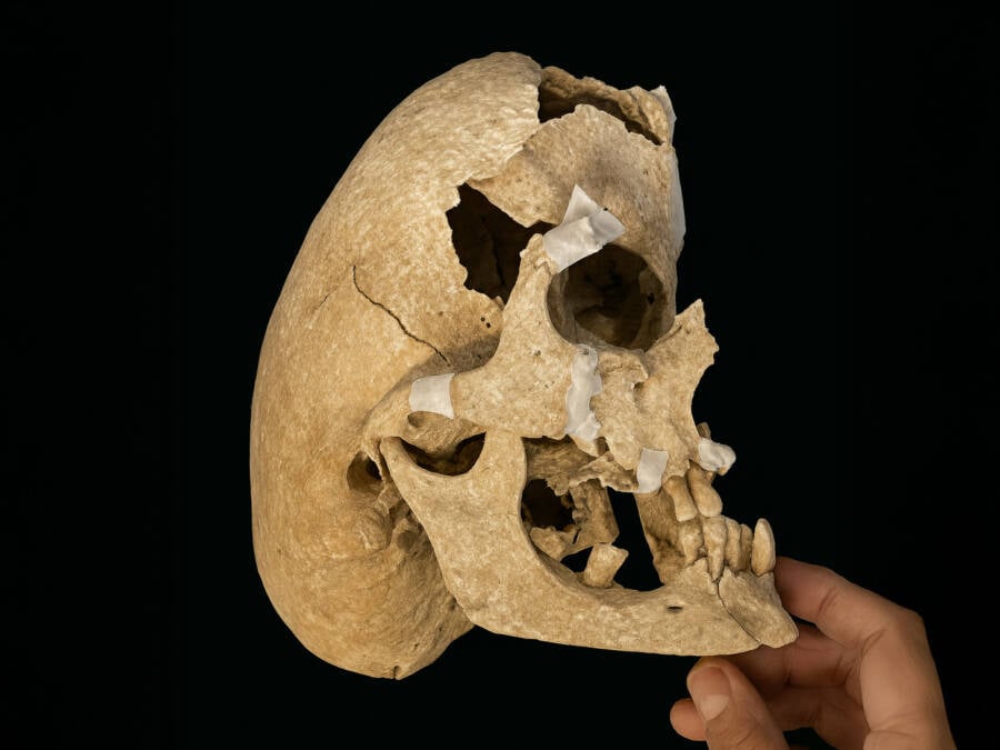 Unearthing Mystery: Severely Deformed Skull of a Medieval Warrior Found on Spanish Battlefield Raises Chilling Questions