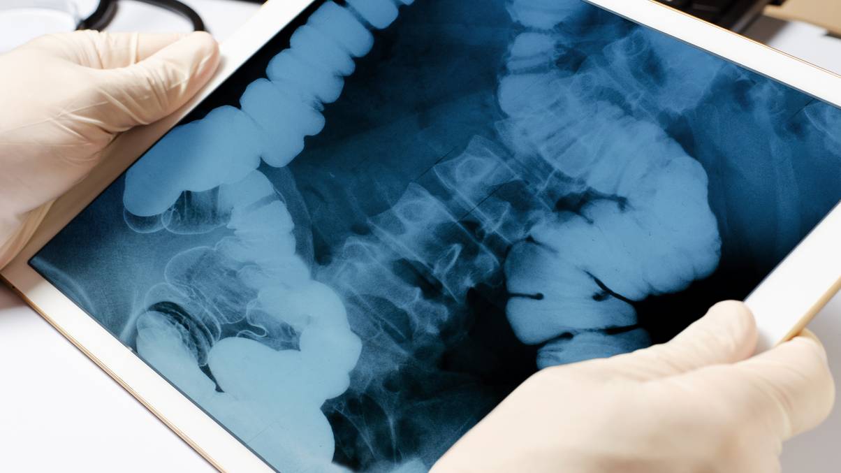 Man Arrives at Hospital with Shocking WWI Bomb Secret Hidden Inside—Doctors Left Stunned