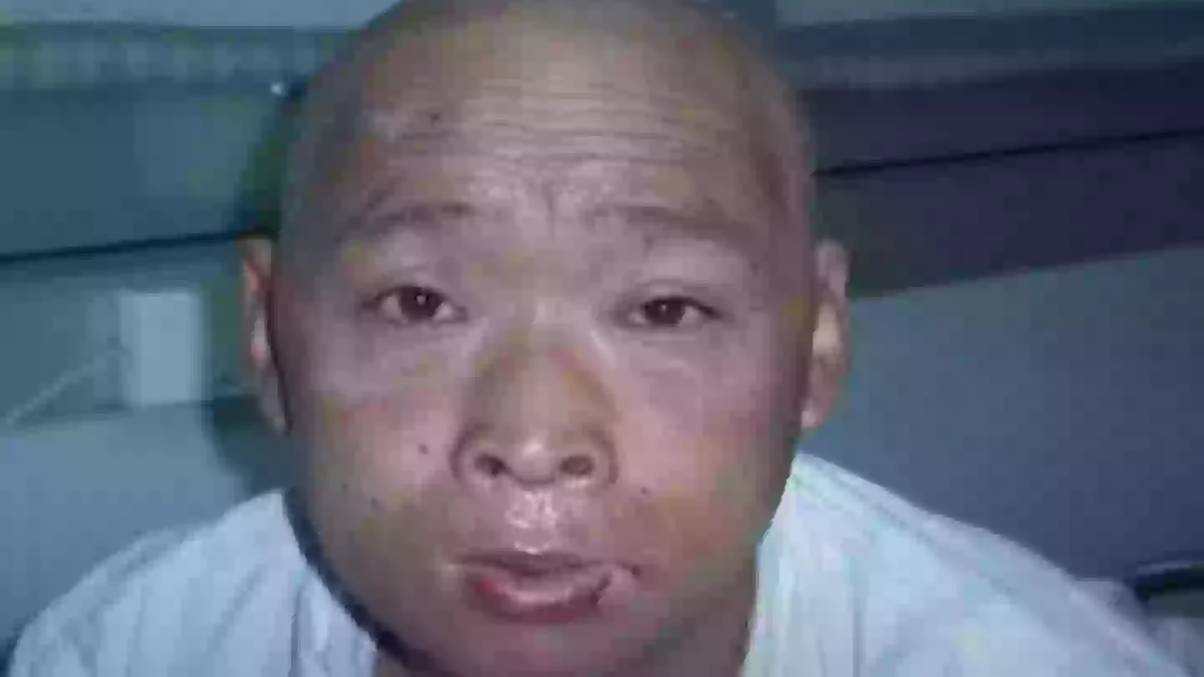 The Shocking Truth Behind the 'Radioactive Man's' 83-Day Ordeal – Only One Organ Survived the Agony