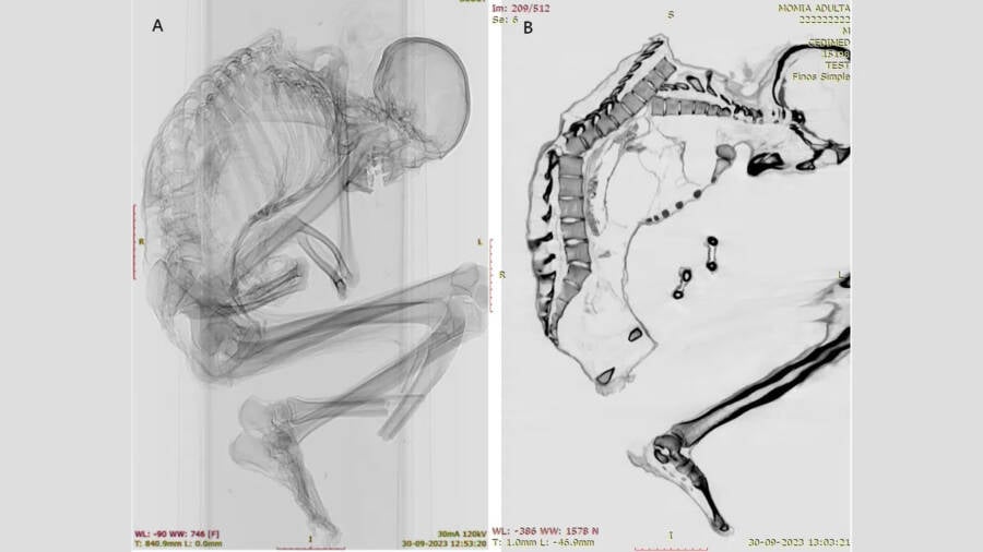 Mystery Uncovered: Ancient Chilean Mummy’s Death Linked to Deadly Turquoise Mine Collapse After 1,100 Years