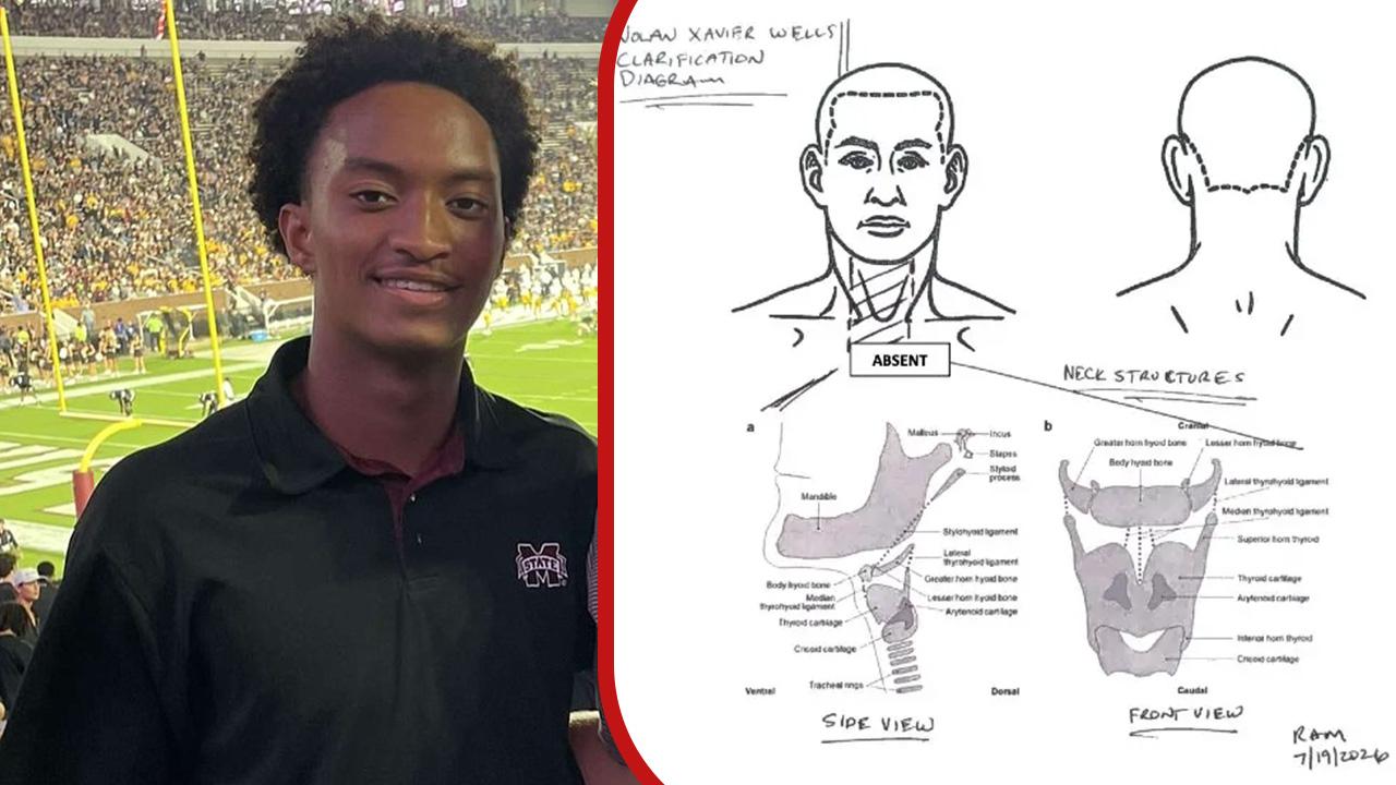 Mysterious Red Mark on Nolan Wells' Neck Sparks Fresh Questions in Shocking Autopsy Report After Fatal Fourth of July Outing
