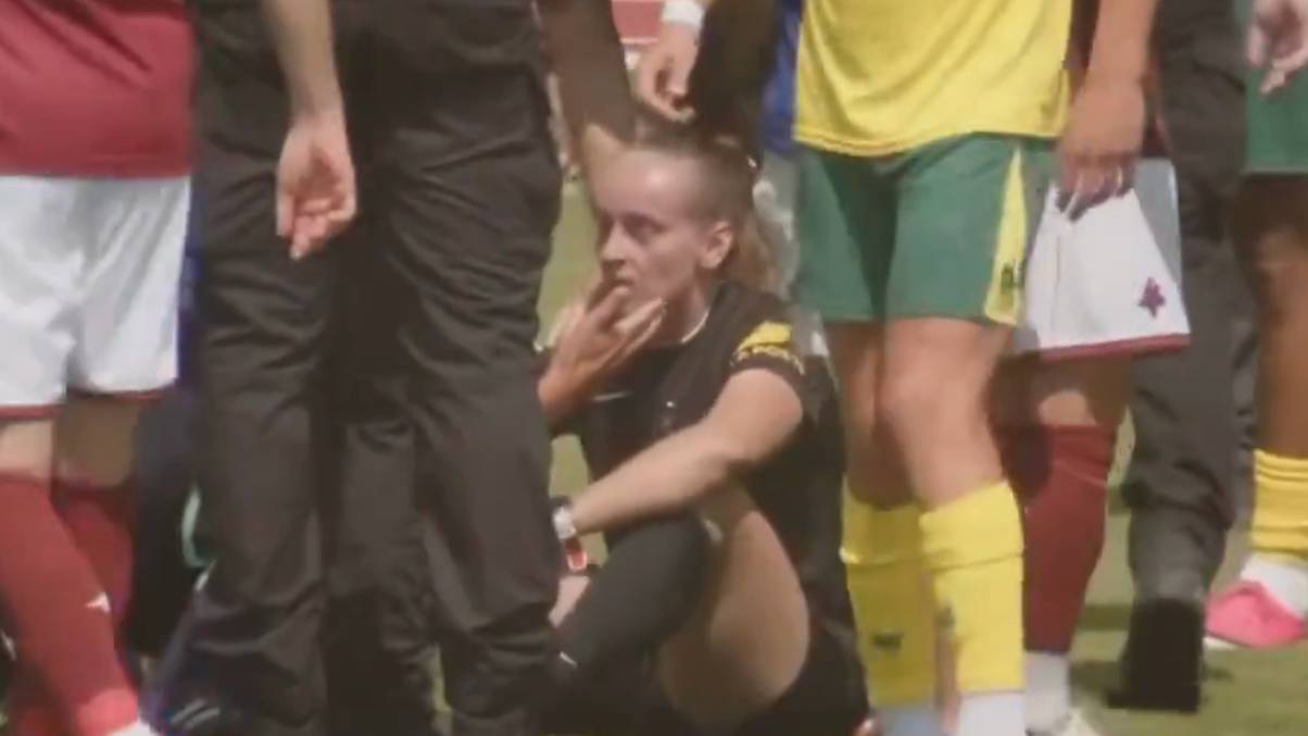 Shocking Chaos: Female Referee Concussed in Explosive Men's Game Brawl—What Really Sparked the Violence?