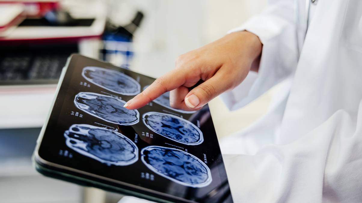 The Surprising Morning Choice That Could Shield You from Dementia, According to Doctors
