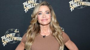 Denise Richards Reveals Surprising Truth Behind Dramatic Face Lift Transformation