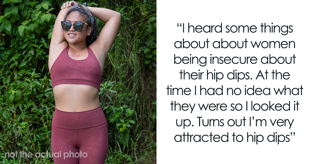 Discover the Unexpected Beauty in 30 Features Most People Call Unattractive