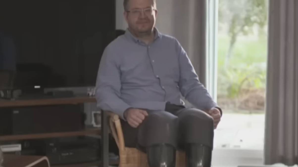 NHS Surgeon’s Shocking Self-Amputation Linked to Mysterious Rare Disorder After Bizarre Obsession Revealed