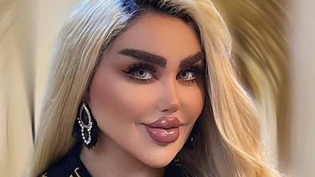 You Won’t Believe What This ‘Human Barbie’ Looked Like Before Her 40+ Jaw-Dropping Surgeries
