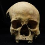 Medieval Chinese Woman’s Horrific Facial Punishment Revealed: What Dark Crime Did She Commit?
