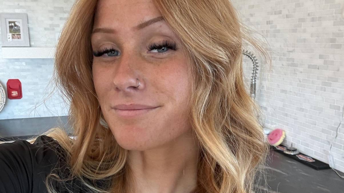 The Shocking Side Effect That Made This Woman Quit Melanotan II After Just Two Weeks